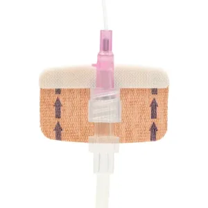 FlexGRIP Neo PIVC dispositivo fijación catéter periférico neonatal con adhesivo seguro