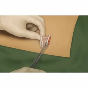 WZIPS BS 60 25 Anillo Retractor F4 1