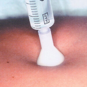 Aguja de Micro-Mesoterapia S.I.T. GIMA · Skin Injection Therapy 31G (Ø 0,26 mm) × 2,5 mm Blanco · Estéril · Caja de 25 uds (Ref. 23694)