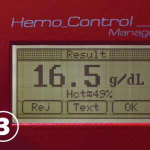 Analizador de Hemoglobina y Hematocrito Hemo Control – GIMA (Ref. 23994) | Método Fotométrico, Muestra 8 µl, Resultado en 25-60 s