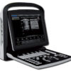 CHISON ECO 3 VET ULTRASOUND