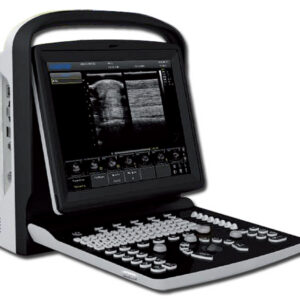 CHISON ECO 3 VET ULTRASOUND