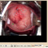 COLPOSCOPY SOFTWARE for 29620, 29622, 29600 with 29603