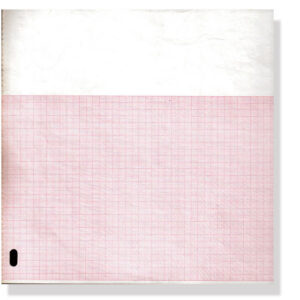ECG thermal paper 210x300mm x200s pack - orange grid