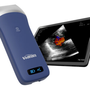 Ecógrafo portátil inalámbrico GIMA Viatom Linear – Sonda lineal 7,5-10 MHz – Ref. 33931