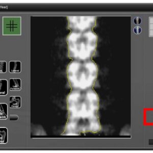 PRIMUS DEXA Full-Body Fan-Beam System
