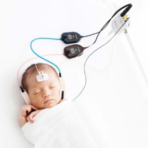 Equipo de cribado auditivo neonatal ABR + EOA Maico easyScreen