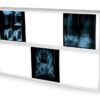 LIGHT BOX 76X122 cm - 2x3 panels