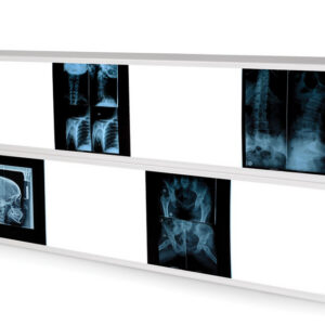 LIGHT BOX 76X153 cm - 2x4 panels