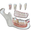 Mandíbula Inferior 3X con 6 Partes – Modelo Anatómico de Hemimandíbula Adulta para Docencia en Odontología (Ref. GM40210) | GIMA