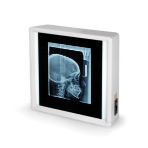 Negatoscopio GIMA 38x38 cm – Light Box de 1 panel con luz fría 6.500 K para lectura de placas de radiología (Ref. 27364)