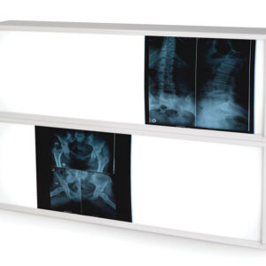Negatoscopio GIMA 76x122 cm – Light Box de 2x3 paneles con luz fría 6.500 K para lectura de placas de radiología (Ref. 27369)