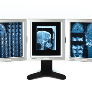 Negatoscopio LED de sobremesa ultraplano 42x36 cm GIMA – Doble panel (Ref. 44706)