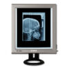 Negatoscopio LED ultrapiano de sobremesa 42 × 36 cm – GIMA (Ref. 44705)