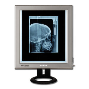 Negatoscopio LED ultrapiano de sobremesa 42 × 36 cm – GIMA (Ref. 44705)