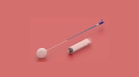 posparto