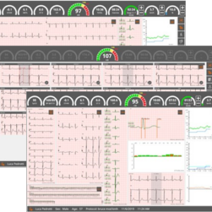 Sistema de prueba de esfuerzo Cardioline Cubestress HD+ digital