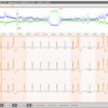 Sistema Holter ECG Cardioline Cubeholter