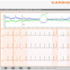 Software Cardioline ECGWebApp Holter