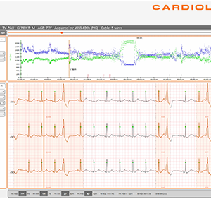 Software Cardioline ECGWebApp Holter