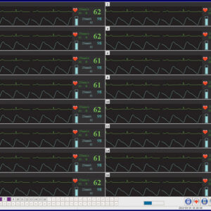 Software Central Station para Monitorización Central de Signos Vitales (Hasta 64 Camas) – GIMA 35323