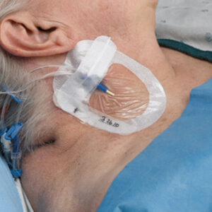 TEGADERM 3M I.V. ADVANCED 8.5x11.5 cm for central lines