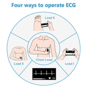 Tensiómetro de Brazo GIMA ARMFIT+ con ECG – Monitor Oscilométrico de Presión Arterial con Registro Electrocardiográfico y Bluetooth 4.0 (Ref. 35198)