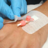 Fijación de cánula intravenosa Transafix con apósito no adhesivo 6 x 8 cm